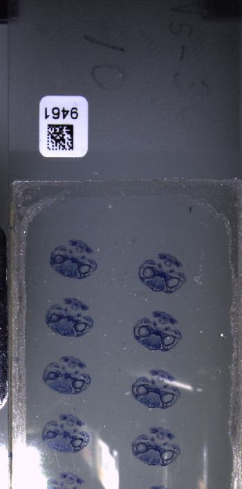 Media type: image; Special Collections 3102   shows specimen_part histological serial section;  Description: Whole slide scan, SC-3102, slide 10;